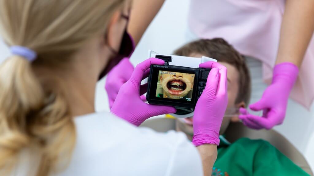 aparat-dentar-fix-sau-alignere-ghid-pentru-parin-i-i-adul-i-din-bucure-ti-cum-alegi-tratamentul-ortodontic-potrivit-i-ce-presupune-fiecare-etapa3